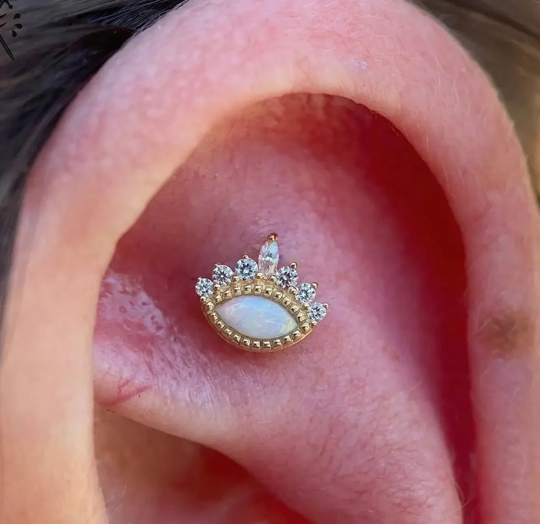 Étoile et pierres sur le cartilage